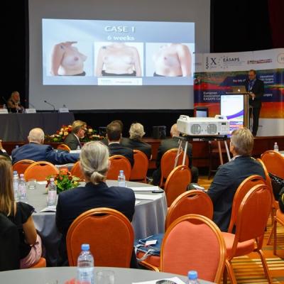 Day 2 Easaps 2017 1900