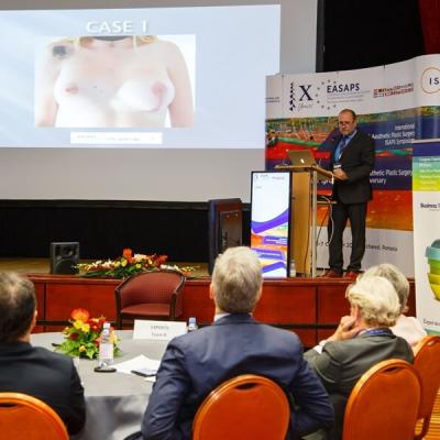 Day 2 Easaps 2017 1902